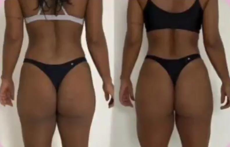 Antes e depois — resultado de aluno